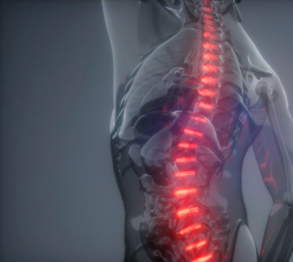 SKELETON® | Fajas Ortopédicas de Alta Calidad 81 SKELETON® | Fajas Ortopédicas de Alta Calidad